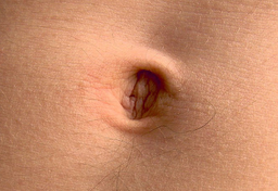 Cywilizacja Zachodnia zapatrzona we własny pępek